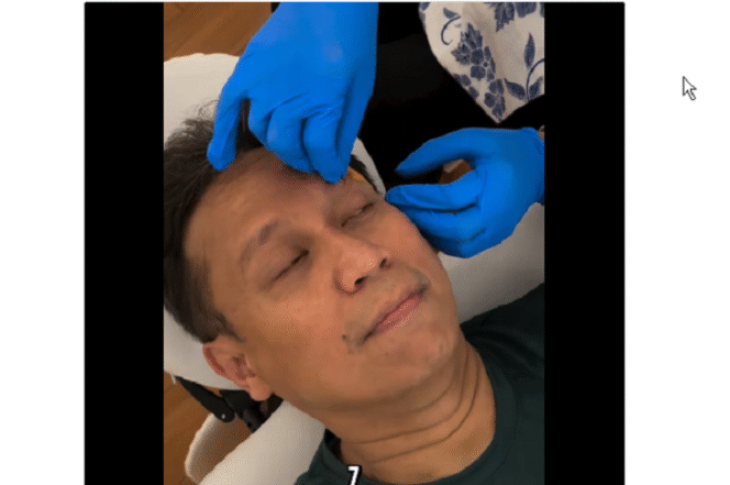 
					Menteri Kesehatan Budi Gunawan Sadikin mendapat perawatan di RSCM, untuk menjahit luka di pelipis kanan 2.5, akibat terpeleset di kamar mandi, Minggu 2 Februri 2025. Tangkap Layar Video Instagram@bgsadikin