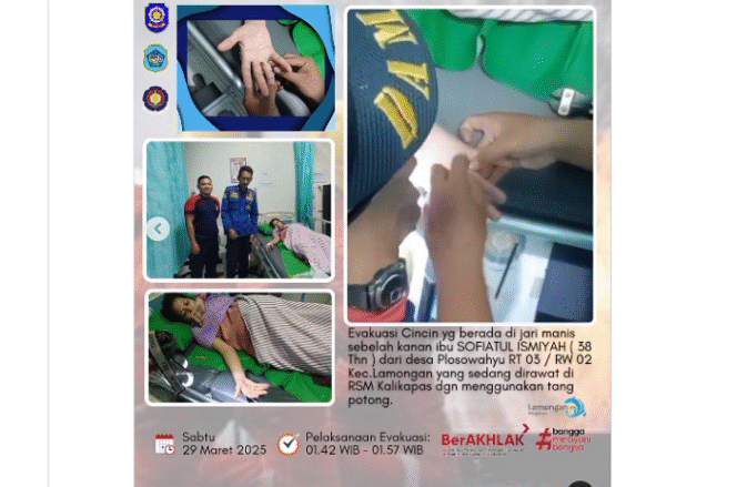 
					Seorang ibu hamil dari RS Muhammadiyah Lamongan dibawa ke kantor Damkar Pemkab Lamongan, untuk mendapat pertolongan melepaskan cicin yang melekat di jarinya yang tidak bisa dicopot. 
Instagram@damkarlamongan.official