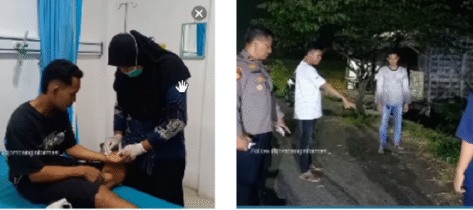 
					Dwi Nur Imam, 24, warga Carangrejo, kecamatan Kesamben, Jombang, menjadi korban begal saat melintas di Jalan Bypass Desa Betek, Kecamatan Mojoagung, Kabupaten Jombang. Terjadi Sabtu, 29 Maret 2025. sekitar pukul 19.30 WIB. Tangkap layar video Instagram@jombanginformasi_