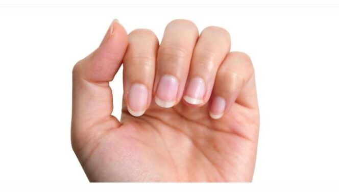 
					Kuku jari tangan tunjukkan kesehatan Anda