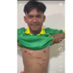 pemain bola Pewrseta Tulungagung, Firman Nugraha membuka jerseynya, tampak masih ada beberapa memar di dadanya. Ia  adalah korban   tendangan brutal dari Muhammad Hilmi (Putra Jaya) Pasuruan dalam laga 4 Jatim babak 32 besar melawan Perseta 1970 pada 5 Januari 2026 di Stadion Gelora Bangkalan, Madura. Foto: Instagram@emosijiwakucom