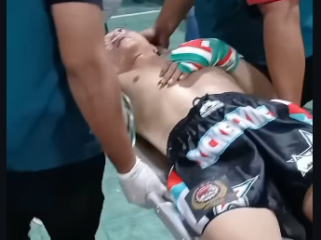 Petugas ring terpaksa menandu Husein Pati keluar ring, setelah KO melawa Eko Hariyanto pada acara combat ala  MMA di Purwodari Grobogan, Jateng, Minggu 6 April 2026. Hussein semakin terpuruk, setelah dianggap sebagai pengkhianat wartga Patim dalam upaya memazkulkan Sudewo. Tapi KPK malah di-OTT oleh KPK. Foto: ponorogo_trending