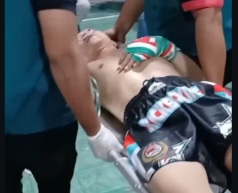 Petugas ring terpaksa menandu Husein Pati keluar ring, setelah KO melawa Eko Hariyanto pada acara combat ala  MMA di Purwodari Grobogan, Jateng, Minggu 6 April 2026. Hussein semakin terpuruk, setelah dianggap sebagai pengkhianat wartga Patim dalam upaya memazkulkan Sudewo. Tapi KPK malah di-OTT oleh KPK. Foto: ponorogo_trending