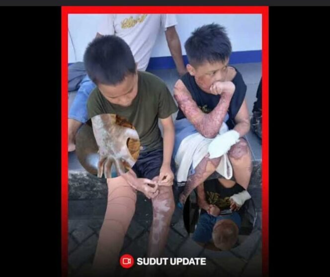 
					Polda NTB Tetapkan Ketua Yayasan dan Satu Santri Jadi Terangka, Kasus Pembakaran 3 Santri Ponpes al Ibrahimy