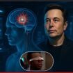 Elon Musk lewat perudahaan Neuralink menghasilkan Blindsght, implan bagi penyandang kebutaan bisa melihat. Foto: ist